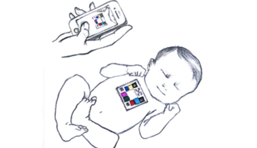 「貝申医療」のAI新生児黄疸検査アプリが政府の医療機器認証を取得 | 36Kr Japan | 最大級の中国テック・スタートアップ専門メディア