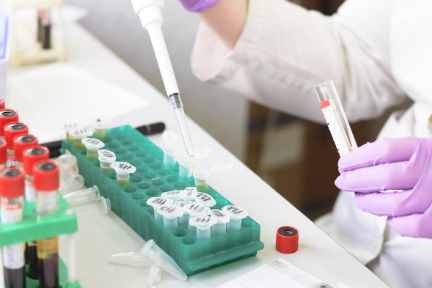 体外診断用医薬品向け機器開発などの「嵐煜生物」：シリーズCで約15億円を調達