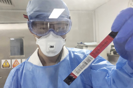 22分で結果が分かる新型肺炎の検査キット、深圳の医療系企業が大学などと共同開発