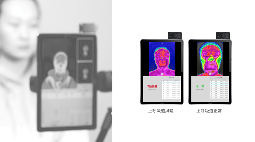 赤外線画像一枚で健康リスクがわかる、経絡AI＋サーモグラフィーによるスクリーニング検査