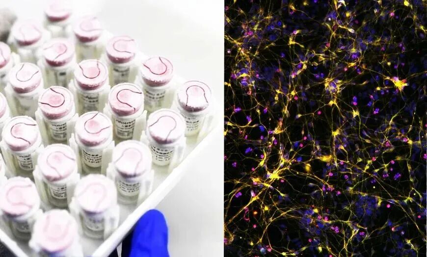 中国のiPS細胞薬開発が加速。睿健医薬「日米と肩を並べる水準に」、シリーズBで累計60億円超を調達